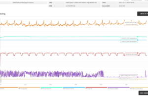lenovo-ideapad-s540-3dmark-stress-stock-monitoring